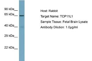 Host: Rabbit Target Name: TCP11L1 Sample Type: Fetal Brain lysates Antibody Dilution: 1. (TCP11L1 Antikörper  (C-Term))
