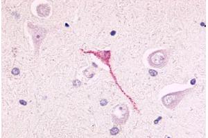 Anti-GPR17 antibody  ABIN1048752 IHC staining of human brain, neurons and glia.