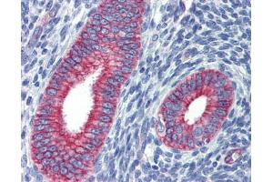 Human uterus; Anti-ZNF71 antibody IHC staining of human uterus. (ZNF71 Antikörper)