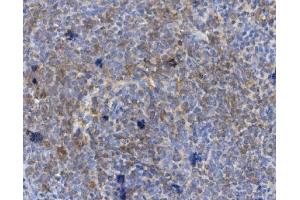 IHC analysis of CD72 using anti-CD72 antibody (ABIN7602483).