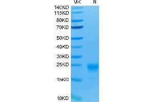 Human IL-5 on Tris-Bis PAGE under reduced condition. (IL-5 Protein (AA 20-134) (His-Avi Tag))