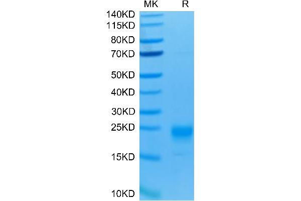 IL-5 Protein (AA 20-134) (His-Avi Tag)