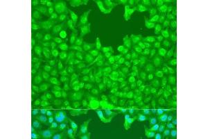 Immunofluorescence analysis of U2OS cells using TAZ Polyclonal Antibody at dilution of 1:100. (TAZ Antikörper)