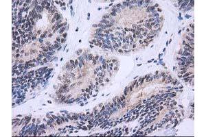 Image no. 8 for anti-Nonhomologous End-Joining Factor 1 (NHEJ1) antibody (ABIN1499729) (NHEJ1 Antikörper)