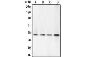 Western blot analysis of Caspase 7 expression in PC12 (A), Jurkat (B), HeLa (C), HEK293T (D) whole cell lysates. (Caspase 7 Antikörper  (N-Term))