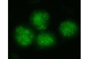 IF analysis of BRD4 using anti-BRD4 antibody (ABIN7602518). (BRD4 Antikörper  (AA 802-1163))