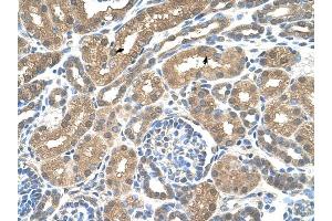 SLC16A8 antibody was used for immunohistochemistry at a concentration of 4-8 ug/ml to stain Epithelial cells of renal tubule (arrows) in Human Kidney. (MCT3 Antikörper)