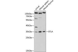 Western blot analysis of extracts of various cell lines, using BTLA antibody (ABIN6129970, ABIN6137689, ABIN6137691 and ABIN6217450) at 1:1000 dilution. (BTLA Antikörper  (AA 31-241))
