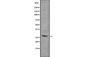 Western blot analysis of RPA30 using COLO205 whole cell lysates