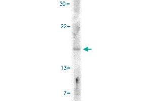 Western blot analysis of IFNB1 in A-20 cell lysate with IFNB1 polyclonal antibody  at 5 ug/mL .