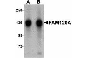 Image no. 1 for anti-Family with Sequence Similarity 120A (FAM120A) (Internal Region) antibody (ABIN478146) (FAM120A Antikörper  (Internal Region))