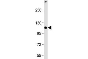 Western Blotting (WB) image for anti-T-Cell, Immune Regulator 1, ATPase, H+ Transporting, Lysosomal V0 Subunit A3 (TCIRG1) (AA 668-702) antibody (ABIN5647614)