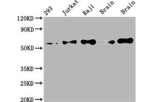 Western Blot Positive WB detected in: 293 whole cell lysate, Jurkat whole cell lysate, Raji whole cell lysate, Mouse brain tissue, Rat brain tissue All lanes: PAK2 antibody at 1:2000 Secondary Goat polyclonal to rabbit IgG at 1/50000 dilution Predicted band size: 59 kDa Observed band size: 59 kDa (Rekombinanter PAK2 Antikörper)