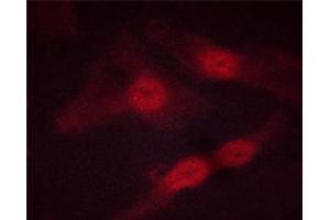 ABIN6267513 staining HeLa cells by ICC/IF. (STAT5 A/B Antikörper  (pSer725, pSer730))