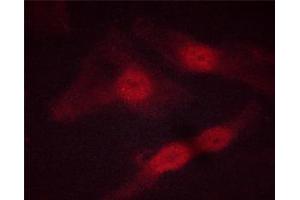 ABIN6267513 staining HeLa cells by ICC/IF. (STAT5 A/B Antikörper  (pSer725, pSer730))