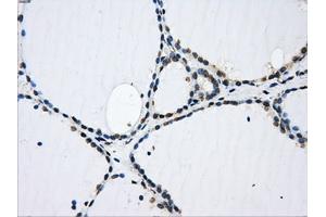 Immunohistochemical staining of paraffin-embedded pancreas tissue using anti-GBE1 mouse monoclonal antibody. (GBE1 Antikörper)