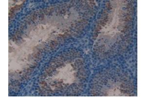 IHC-P analysis of Mouse Testis Tissue, with DAB staining. (Lactoferrin Antikörper  (AA 63-193))