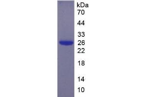 SDS-PAGE analysis of Human EBI3 Protein. (EBI3 Protein)