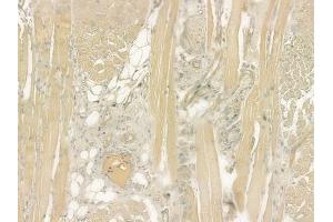 ABIN6260106 and ABIN6276528 at 1/100 staining human tongue carcinoma by IHC-P. (ATG4C Antikörper  (N-Term))