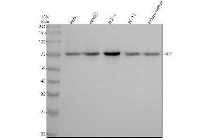 Western blot analysis of NF2 using anti-NF2 antibody (ABIN7605709).