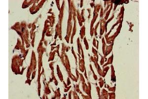 Immunohistochemistry of paraffin-embedded human heart tissue using ABIN7163262 at dilution of 1:100