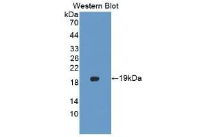 Western blot analysis of the recombinant protein. (PLTP Antikörper  (AA 337-479))