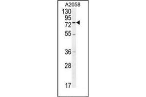 Western blot analysis of ENTHD1 Antibody (N-term) in A2058 cell line lysates (35ug/lane). (ENTHD1 Antikörper  (N-Term))