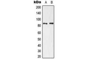 Western blot analysis of Cortactin (pY421) expression in HeLa UV-treated (A), NIH3T3 H2O2-treated (B) whole cell lysates. (Cortactin Antikörper  (pTyr421))