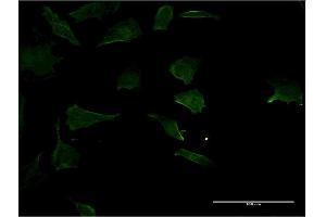 Immunofluorescence (IF) image for anti-Ras Homolog Gene Family, Member C (RHOC) (AA 1-193) antibody (ABIN513476)