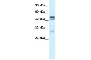 WB Suggested Anti-CHRNA3 Antibody Titration:  0. (CHRNA3 Antikörper  (N-Term))