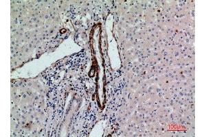 Immunohistochemistry (IHC) analysis of paraffin-embedded Human Liver, antibody was diluted at 1:100. (RHAG Antikörper  (N-Term))