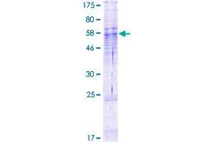 Image no. 1 for Abhydrolase Domain Containing 13 (ABHD13) (AA 1-337) protein (GST tag) (ABIN1305512) (ABHD13 Protein (AA 1-337) (GST tag))