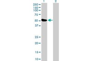 Western Blot analysis of ZBTB26 expression in transfected 293T cell line by ZBTB26 MaxPab polyclonal antibody. (ZBTB26 Antikörper  (AA 1-441))