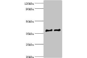 Western blot All lanes: CTSV antibody at 12 μg/mL Lane 1: Jurkat whole cell lysate Lane 2: MCF-7 whole cell lysate Secondary Goat polyclonal to rabbit IgG at 1/10000 dilution Predicted band size: 37 kDa Observed band size: 37 kDa (Cathepsin L2 Antikörper  (AA 105-334))