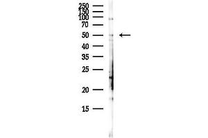 anti-Dihydroorotate Dehydrogenase (DHODH) (Internal Region) antibody
