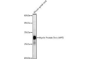 Western blot analysis of extracts of Mouse spinal cord, using Myelin Protein Zero (MPZ) antibody (ABIN3022393, ABIN3022394, ABIN1513218 and ABIN6218782) at 1:1000 dilution. (MPZ Antikörper)