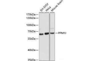 Western blot analysis of extracts of various cell lines using PPM1J Polyclonal Antibody at dilution of 1:3000. (PPM1J Antikörper)