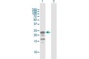 Western Blot analysis of KCNE1 expression in transfected 293T cell line by KCNE1 MaxPab polyclonal antibody. (KCNE1 Antikörper  (AA 1-129))
