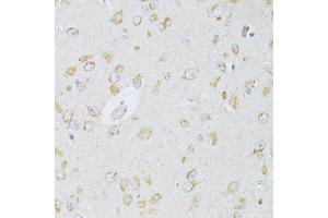 Immunohistochemistry of paraffin-embedded rat brain using NTS antibody (ABIN6290694) at dilution of 1:100 (40x lens). (Neurotensin Antikörper)