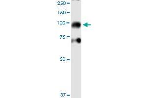 Western Blotting (WB) image for anti-Inhibitor of kappa Light Polypeptide Gene Enhancer in B-Cells, Kinase beta (IKBKB) (AA 3-120) antibody (ABIN516986)