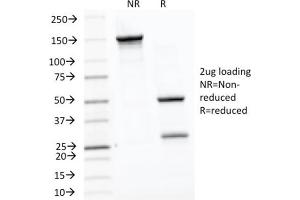 SDS-PAGE (SDS) image for anti-Heat Shock 60kDa Protein 1 (Chaperonin) (HSPD1) antibody (ABIN6939665)