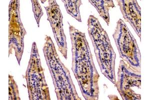IHC analysis of CA2 using anti-CA2 antibody (ABIN6719533). (CA2 Antikörper  (AA 2-260))