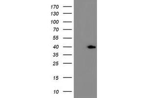 HEK293T cells were transfected with the pCMV6-ENTRY control (Left lane) or pCMV6-ENTRY ERCC1 (Right lane) cDNA for 48 hrs and lysed. (ERCC1 Antikörper)