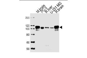 Lane 1: mouse brain lysates, Lane 2: PC-3 Cell lysates, Lane 3: rat liver Cell lysates, Lane 4: U-251 MG Cell lysates, Lane 5: rat brain Cell lysates, probed with USP5 (1340CT704. (USP5 Antikörper)