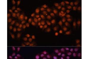 Immunofluorescence analysis of HeLa cells using CDC25A Polyclonal Antibody at dilution of 1:100 (40x lens).