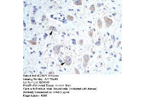 Human Brain (KCNIP1 Antikörper  (N-Term))