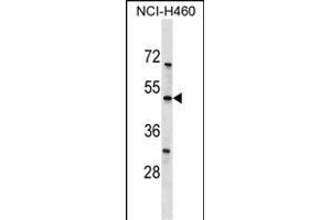 KCNK12 Antibody (C-term) (ABIN1537158 and ABIN2849703) western blot analysis in NCI- cell line lysates (35 μg/lane). (KCNK12 Antikörper  (C-Term))