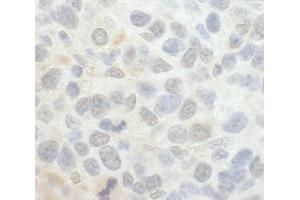Immunohistochemistry (IHC) image for anti-SRSF Protein Kinase 1 (SRPK1) (AA 275-325) antibody (ABIN7448815) (SRPK1 Antikörper  (AA 275-325))