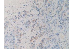 Figure. (SIRPA Antikörper  (AA 105-324))