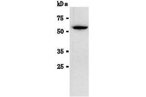 Western Blotting (WB) image for anti-Luciferase antibody (ABIN1108070)